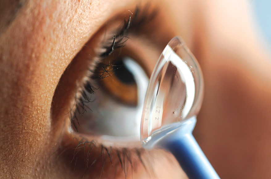 The Growing Ortho-K and Scleral Contact Lens Market and Smart Ways to Sell Them