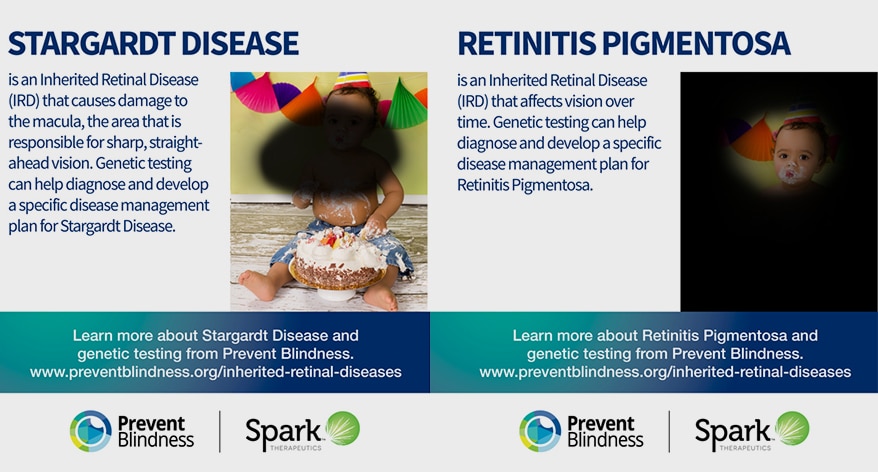Prevent Blindness Declares May 16-22 as Inherited Retinal Disease Genetic Testing Week