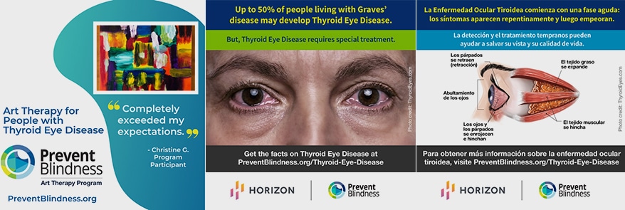 Prevent Blindness Declares 3rd Annual Thyroid Eye Disease Awareness Week, Nov. 14-20