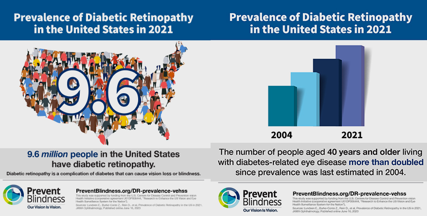 Study Finds Significantly More Adults Living With Diabetic Retinopathy in the United States Than Previously Estimated