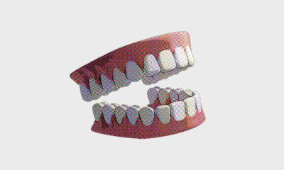 The Chaotic Adventure of An Errant Set of Dentures